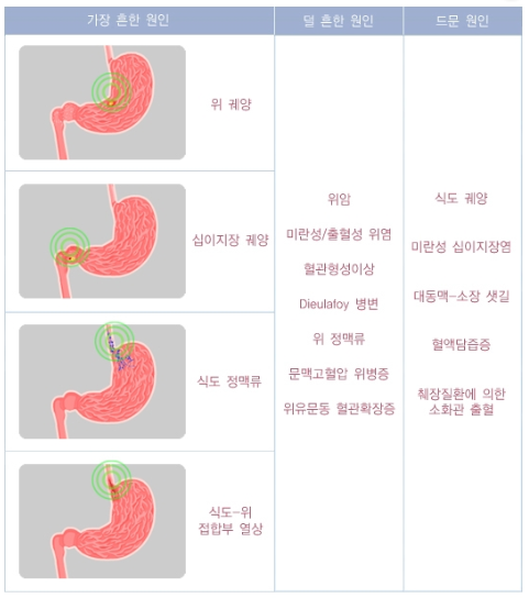 상부위장관 출혈 원인