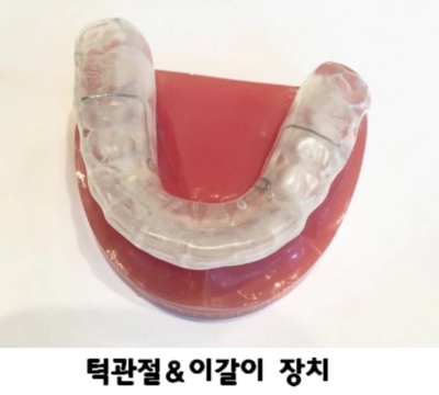 턱관절 및 이갈이 장치 사진