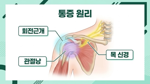 어깨통증 원리 회전근개 관절낭 목 신경 구조 설명