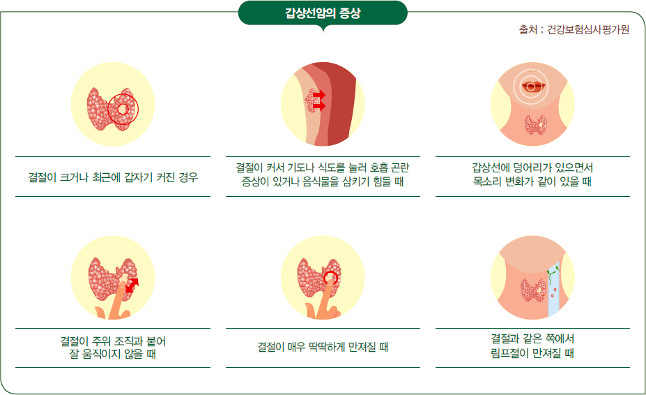 갑상선암 증상