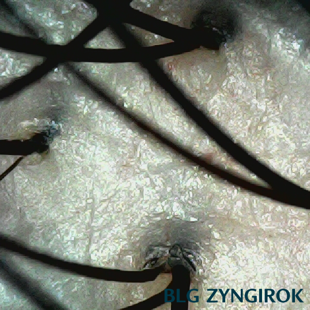 뒷머리 두피 사진이다.