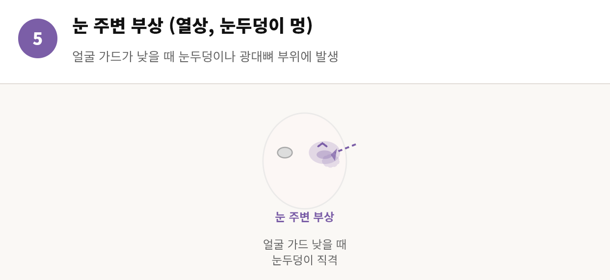스파링하다 다쳤을 때 어떻게 해야 할까 &mdash; 부상별 대처법 완전 정리