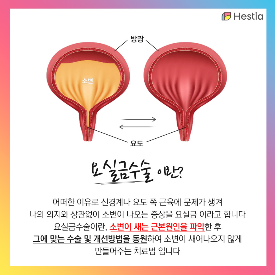 요실금수술이란?