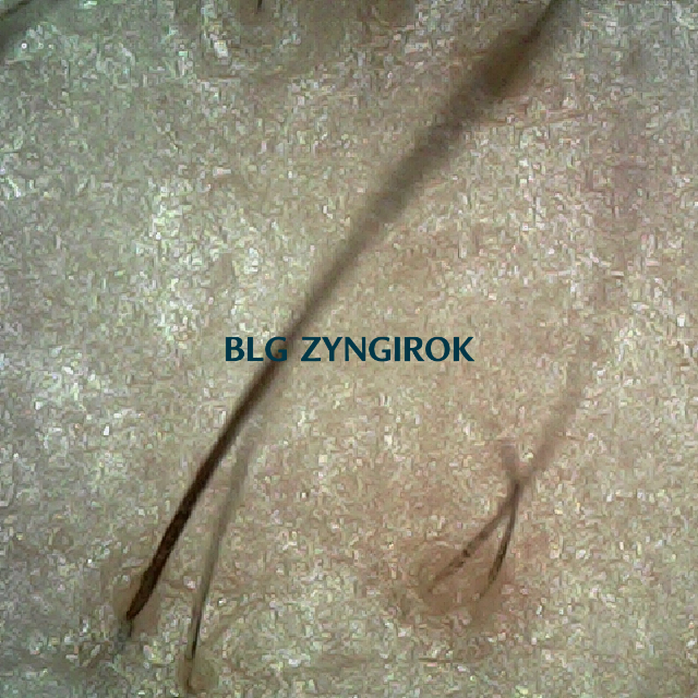 탈모 극복 프로젝트 - 오른쪽 M자 부위 두피 모습이다.