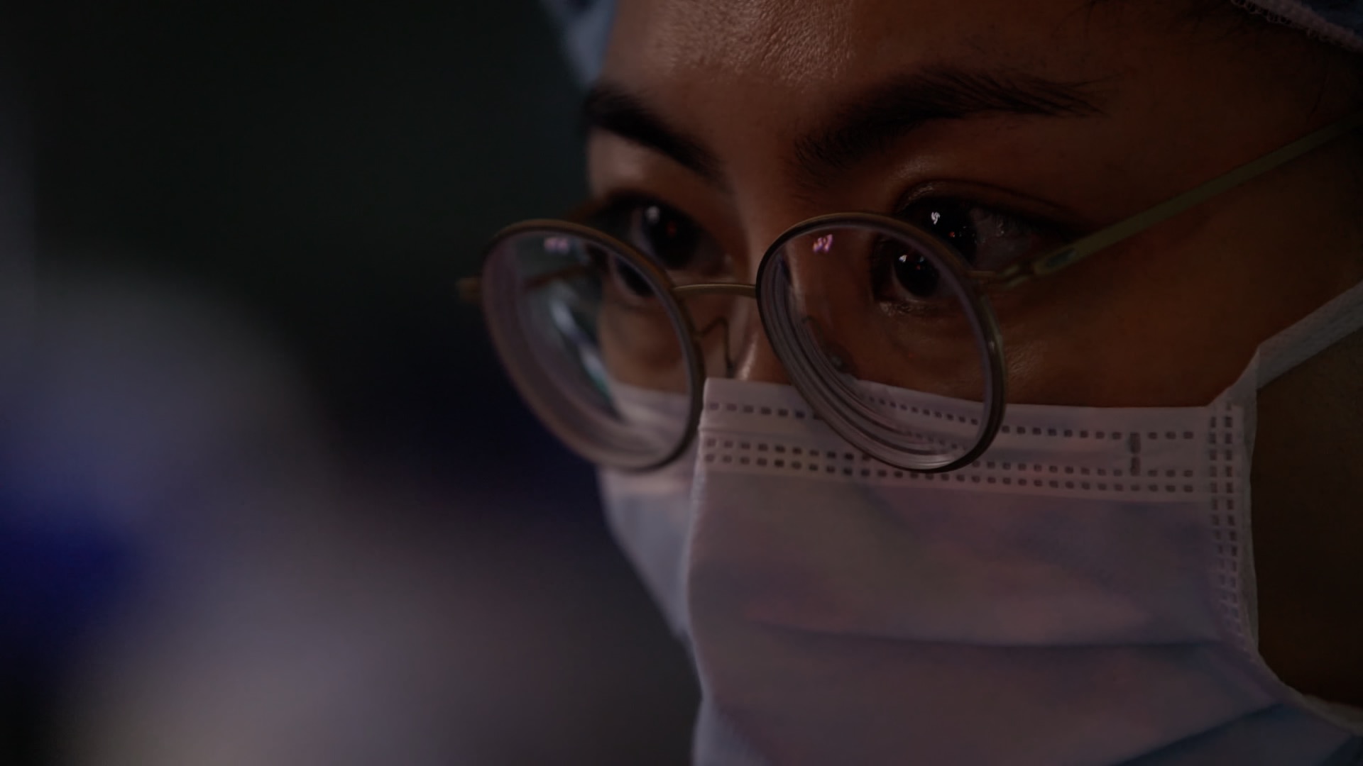 명의 안검하수 안성형