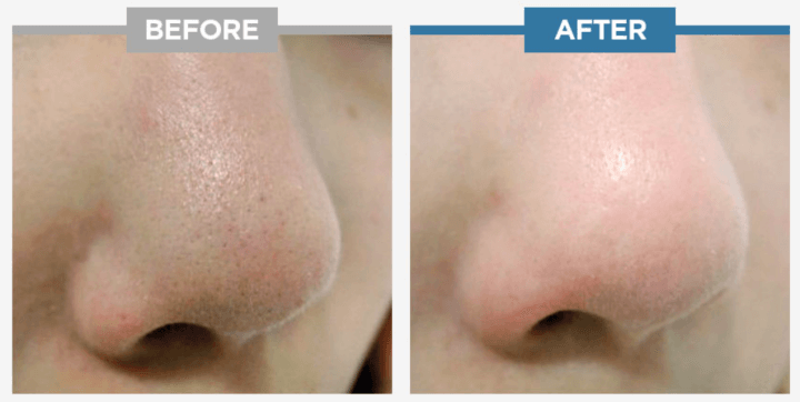 스와니코코-공식-홈페이지에서-가지고-온-제품-효과-사진