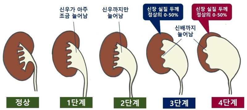 수신증