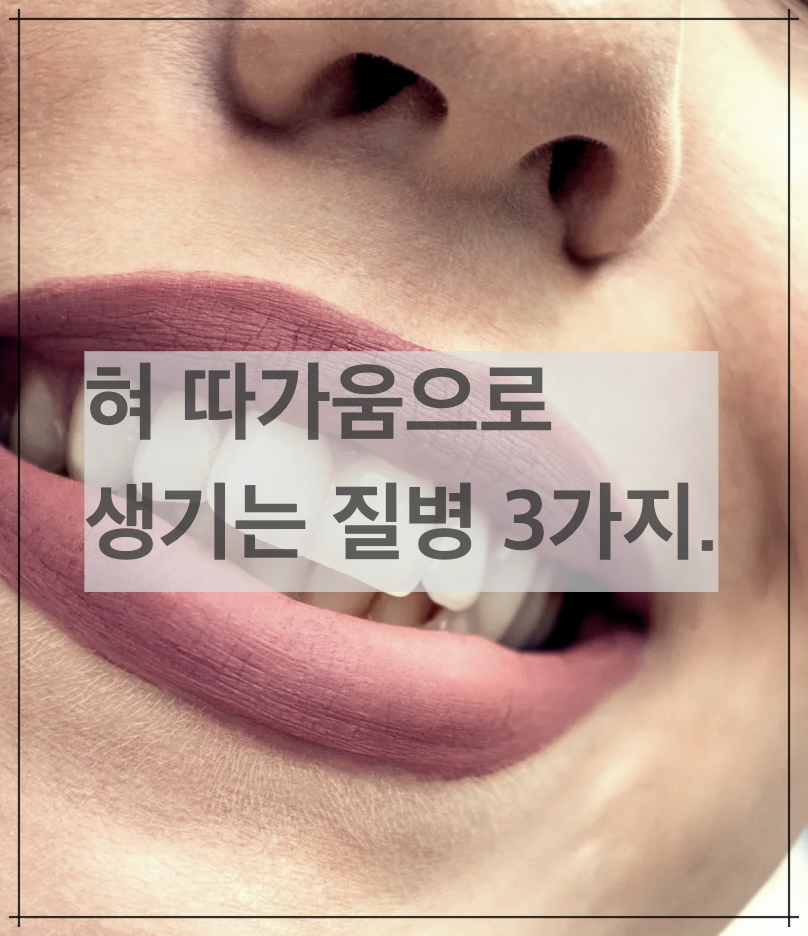 혀 따가움으로 생기는 질병 3가지.