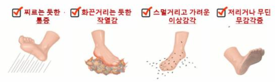 당뇨병성 말초 신경병증의 증상들