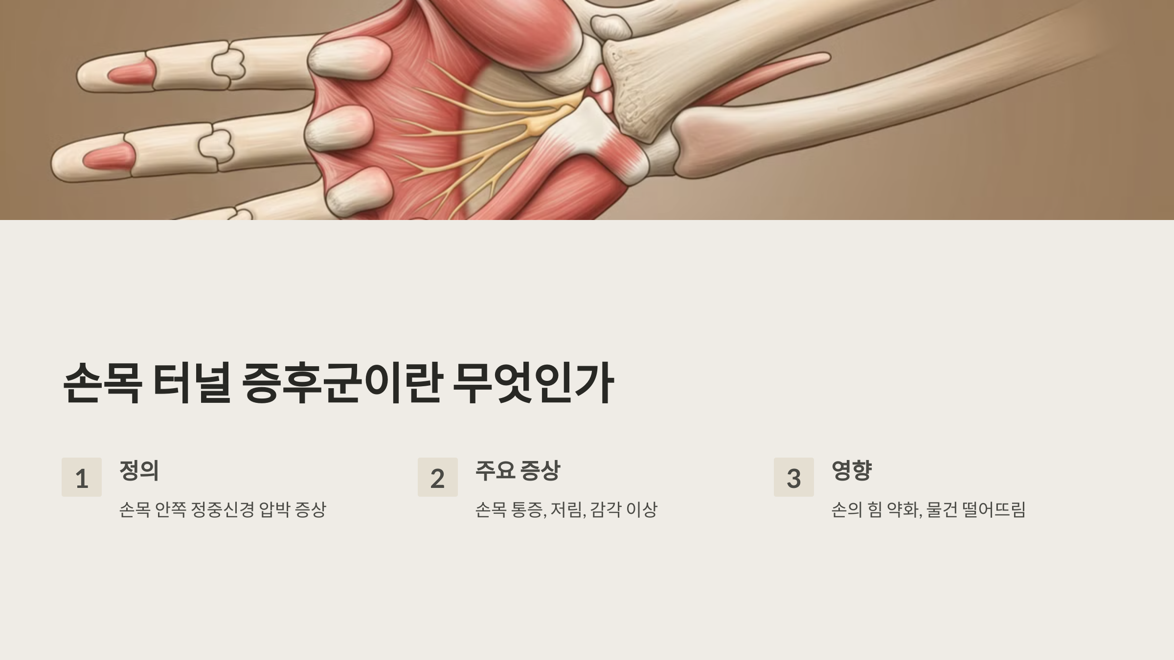 손목 터널 증후군이란 무엇인가