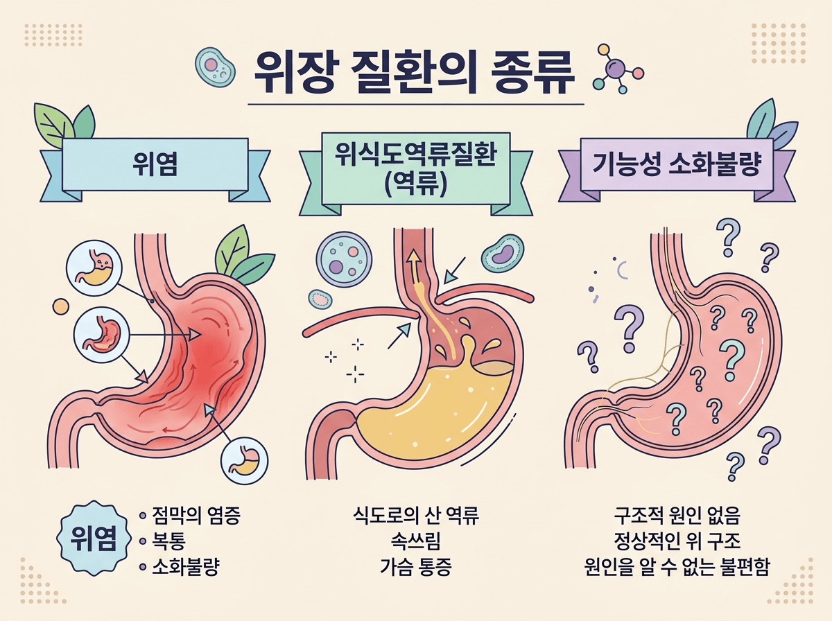 속쓰림 원인 위염 역류성식도염 기능성소화불량 3가지 비교