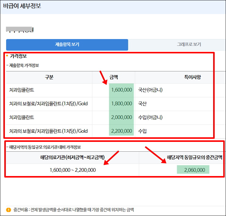 임플란트 가격