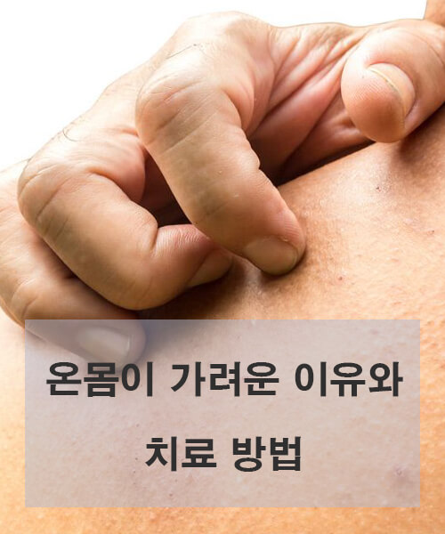 피부-긁는-모습