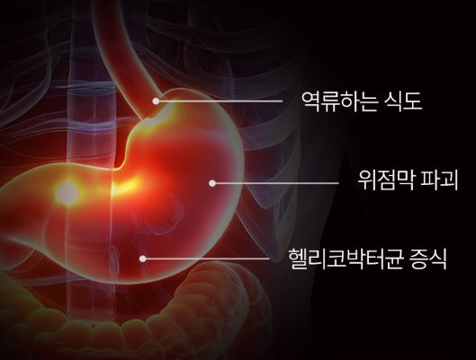 헬리코컷-부스터-효능