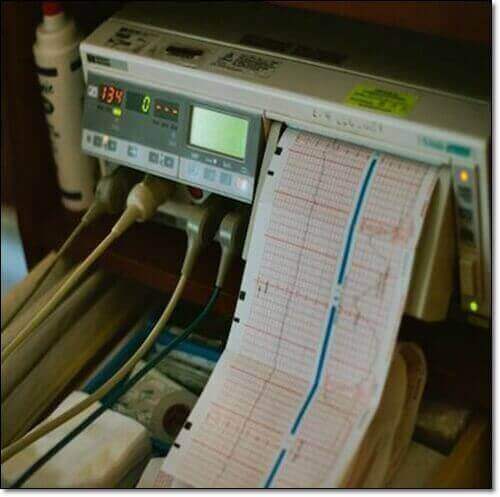 고칼륨 혈증 심전도 검사