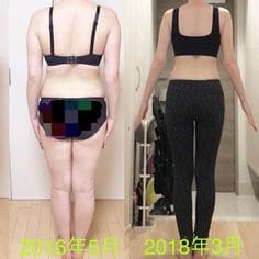 바이오본드