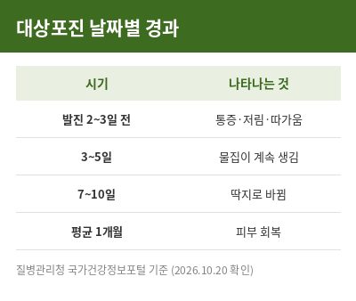 대상포진 초기증상 날짜별 경과