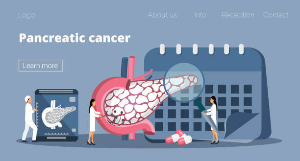 췌장암 초기증상