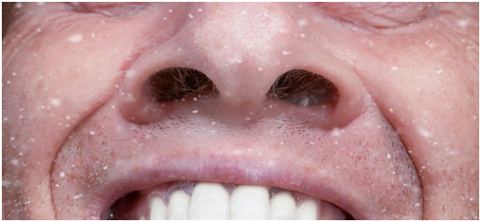 콧속이 건조할 때