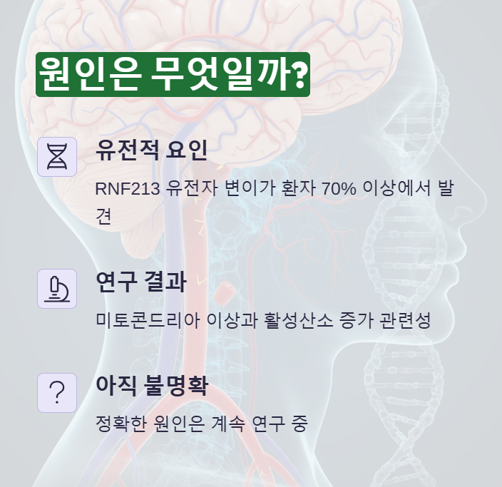 모야모야병 원인