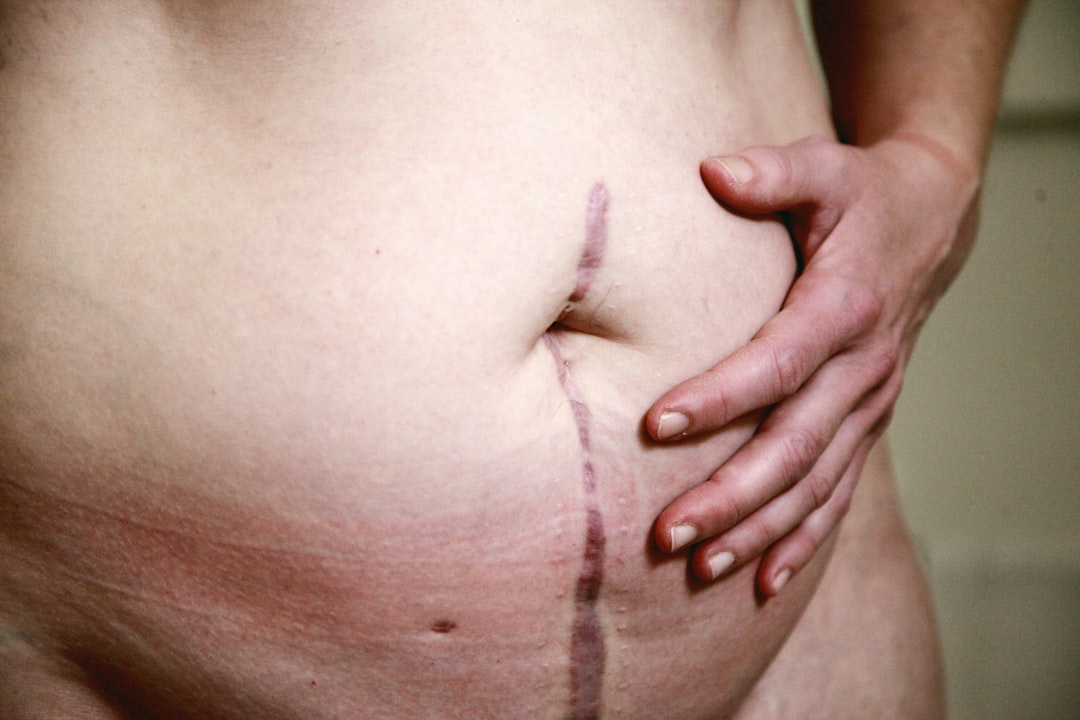 Lower abdominal pain.