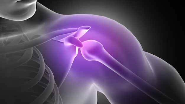 회전근개파열 증상 어깨 통증의 원인