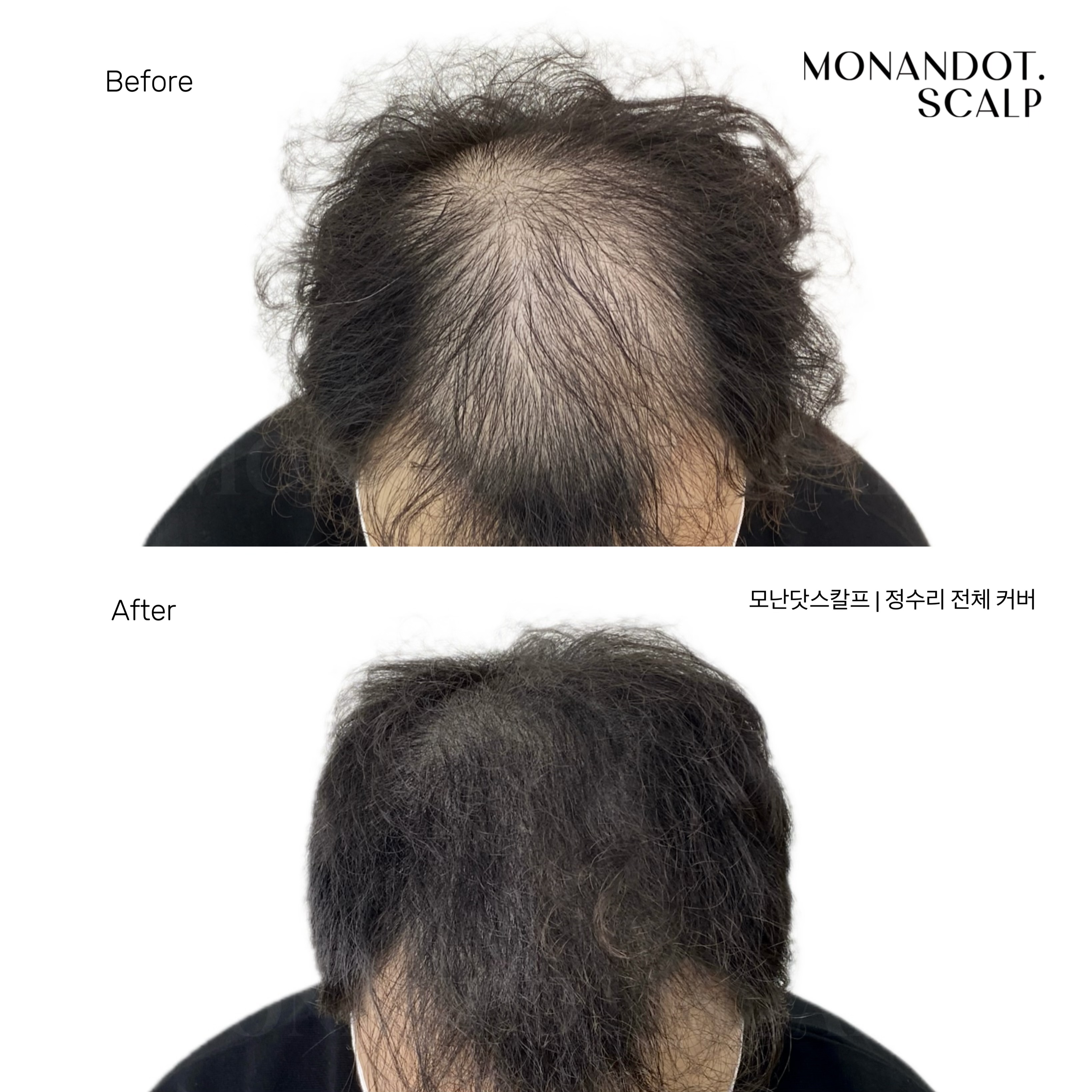 모난닷스칼프
