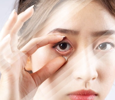 녹내장