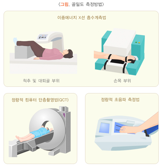 골밀도 검사방법