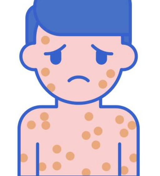 콜린성 두드러기 치료