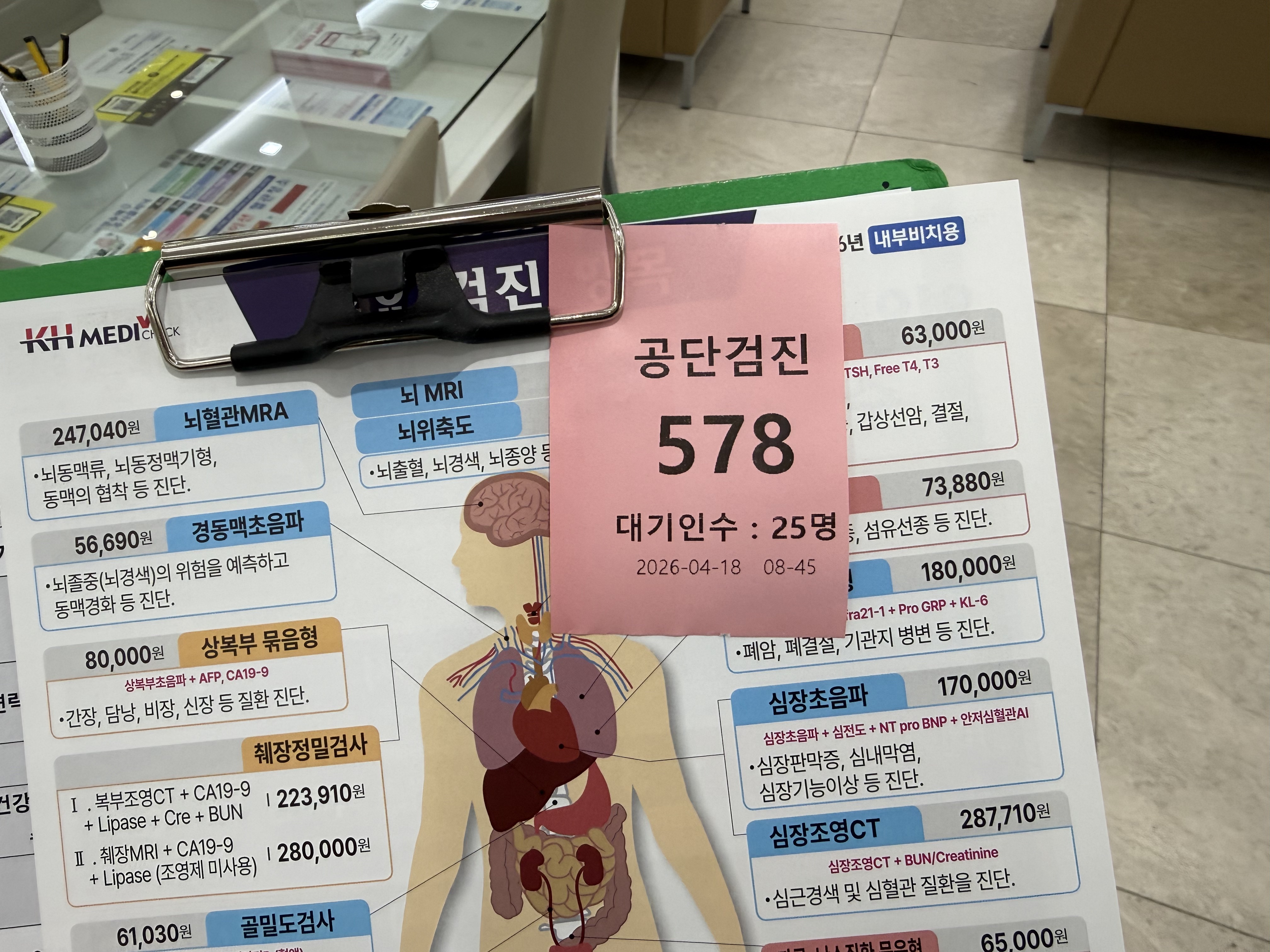 건강검진 공단검진 대기번호 578번 대기인수 25명 검진 가격 안내판