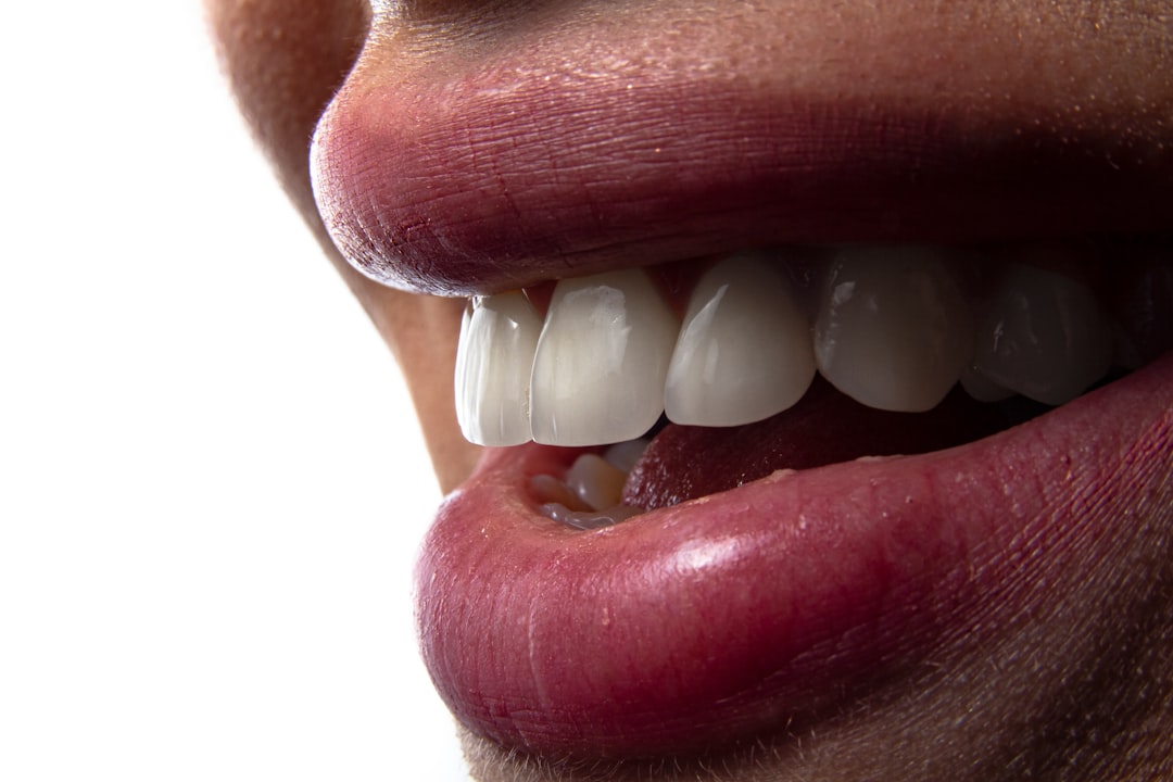 Implant