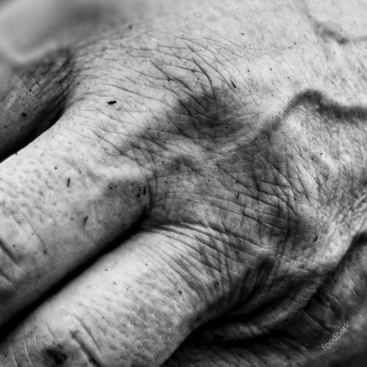 피부 노화 원인