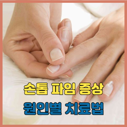 손톱 파임