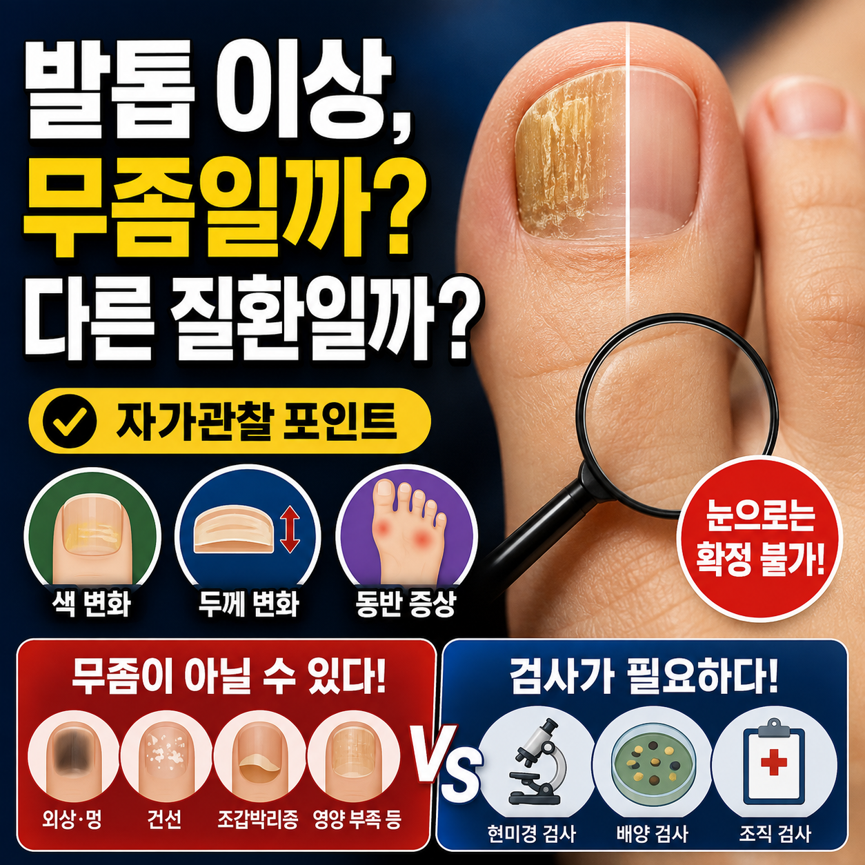 발톱 색과 두께 자가관찰 방법과 피부과 검사 받는 기준