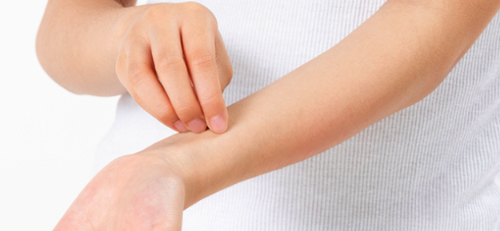 한랭두두러기 관련 이미지