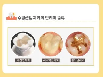 인레이 온레이의 차이와 치료 방법_16