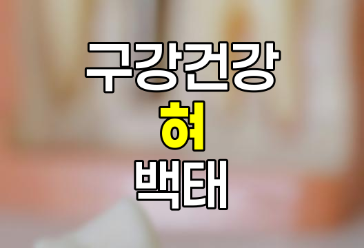 혀 백태 발생 원인, 제거 및 예방 방법 상세 안내