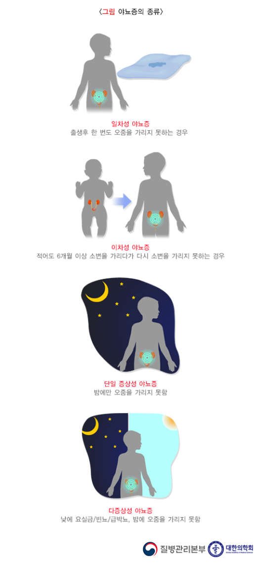 소아야뇨증