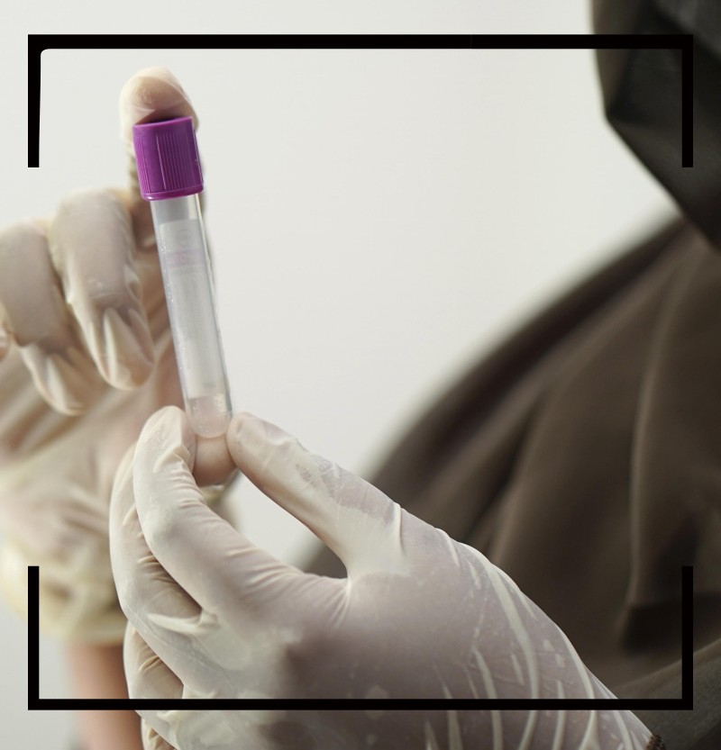 콜레스테롤 정상수치