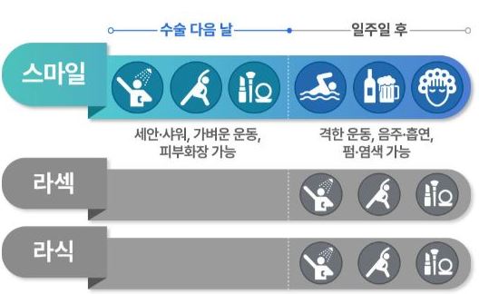 스마일라식-장점