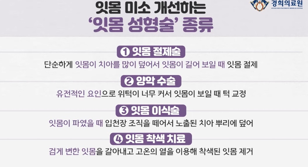 잇몸성형술-종류