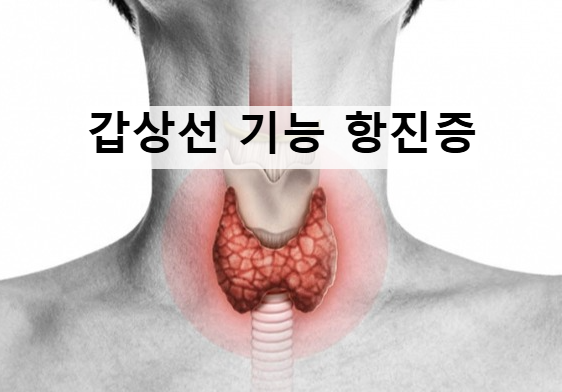 갑상선 기능 항진증