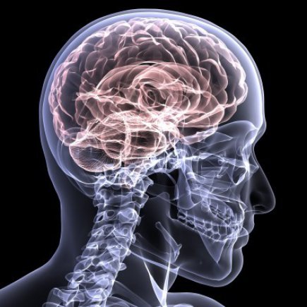 brain x-ray image