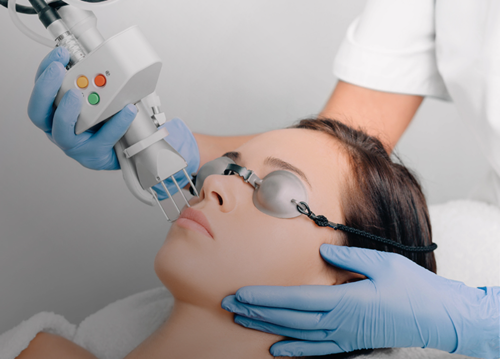 피부레이저 치료 이미지