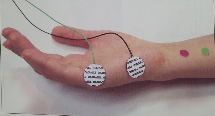 ulnar nerve