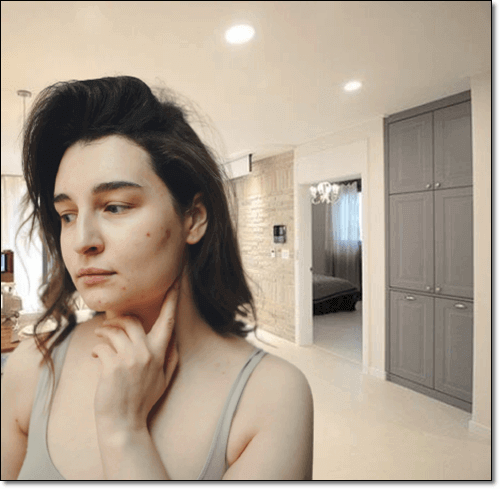 피부염이 있는 여성