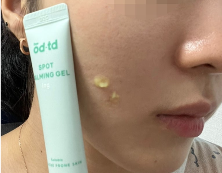 CNP 바이오디티디 스팟카밍젤 효과