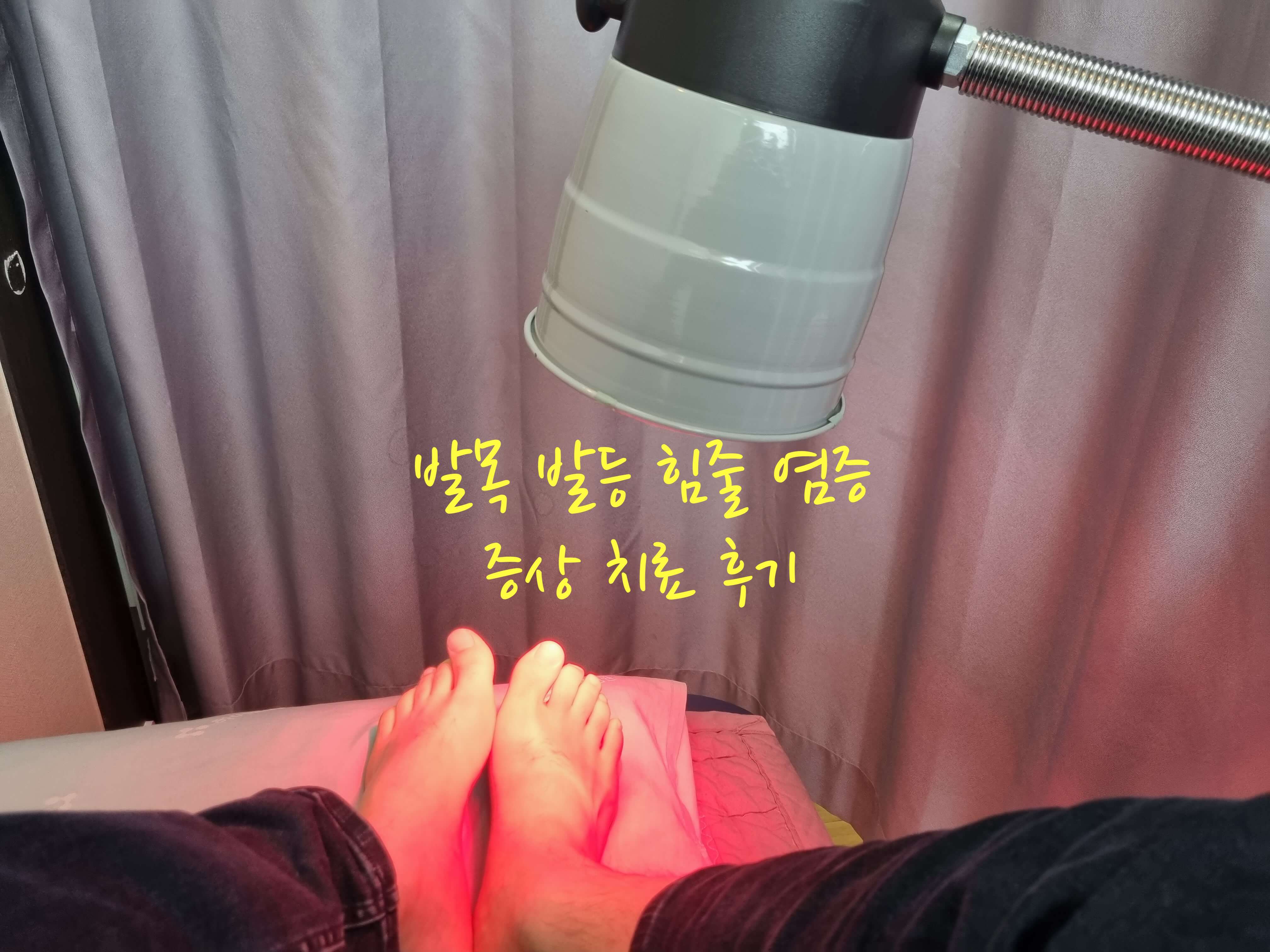 힘줄 염증 후기