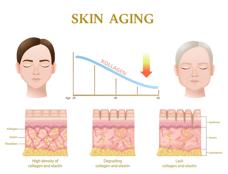 피부에 주름이 생기는 원인